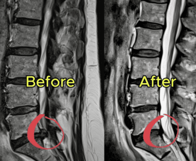 MRI